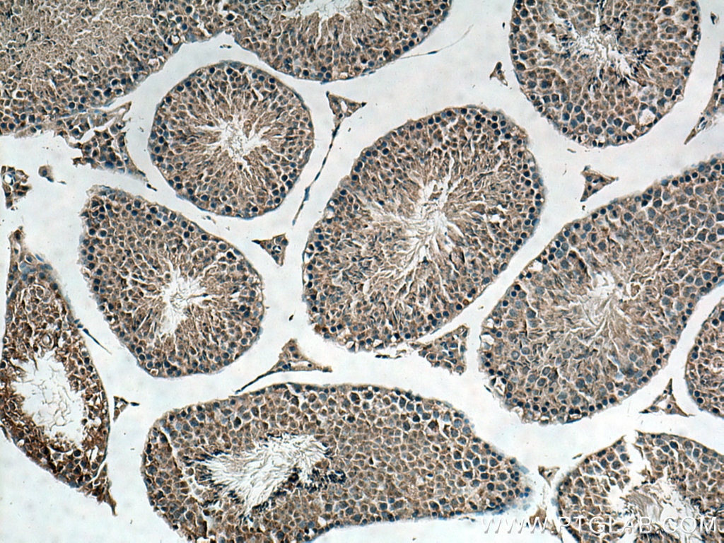 Immunohistochemistry (IHC) staining of mouse testis tissue using SRGAP1 Polyclonal antibody (13252-1-AP)