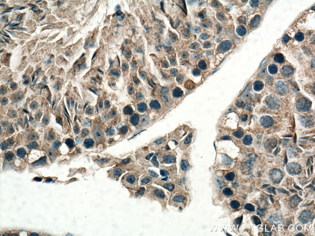Immunohistochemistry (IHC) staining of mouse testis tissue using SRGAP1 Polyclonal antibody (13252-1-AP)