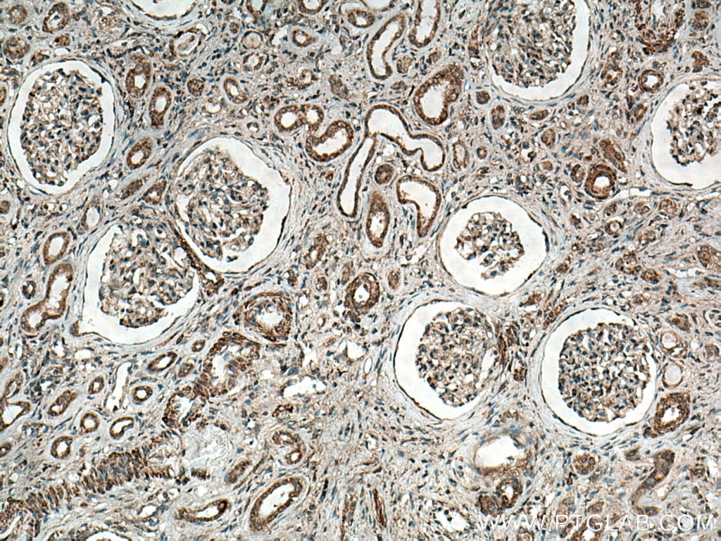 Immunohistochemistry (IHC) staining of human kidney tissue using SRGAP1 Polyclonal antibody (13252-1-AP)