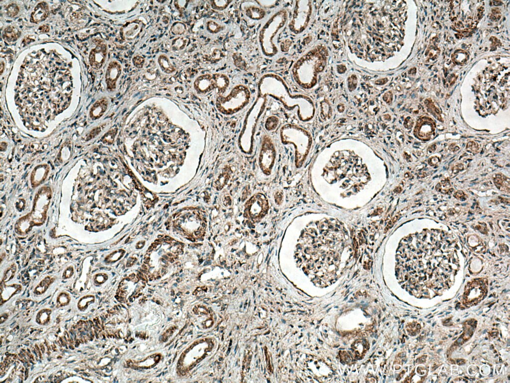 IHC staining of human kidney using 13252-1-AP