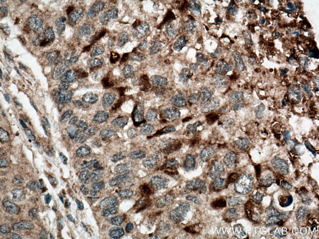 IHC staining of human kidney using 13252-1-AP