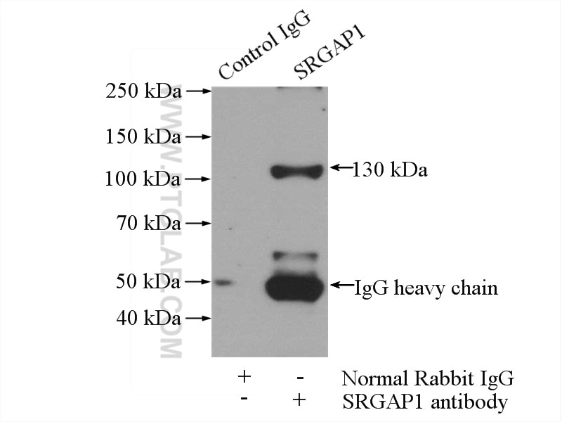 Immunoprecipitation (IP) experiment of mouse kidney tissue using SRGAP1 Polyclonal antibody (13252-1-AP)