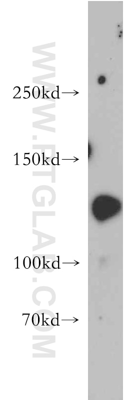 Western Blot (WB) analysis of mouse kidney tissue using SRGAP1 Polyclonal antibody (13252-1-AP)