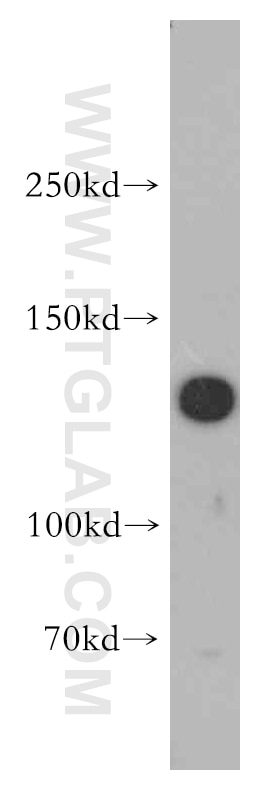 Western Blot (WB) analysis of HEK-293 cells using SRGAP1 Polyclonal antibody (13252-1-AP)