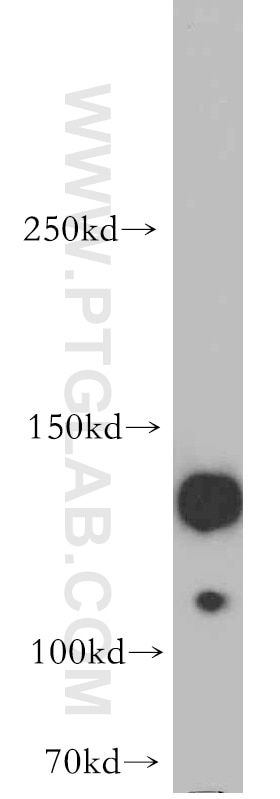 Western Blot (WB) analysis of SH-SY5Y cells using SRGAP1 Polyclonal antibody (13252-1-AP)