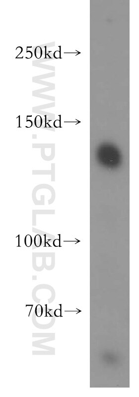 Western Blot (WB) analysis of mouse brain tissue using SRGAP1 Polyclonal antibody (13252-1-AP)