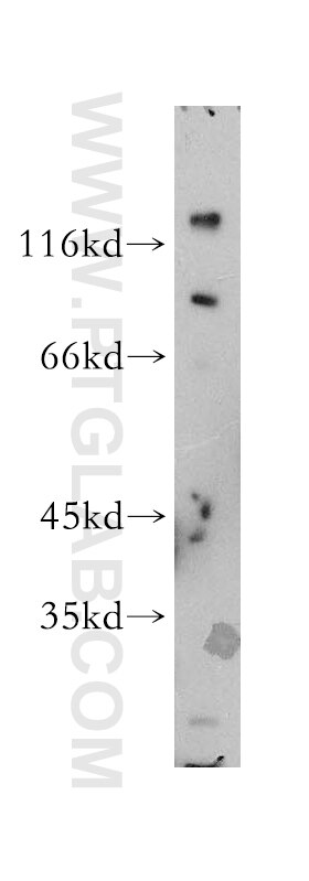 Western Blot (WB) analysis of Apoptosised HeLa cells using SRGAP1 Polyclonal antibody (13252-1-AP)