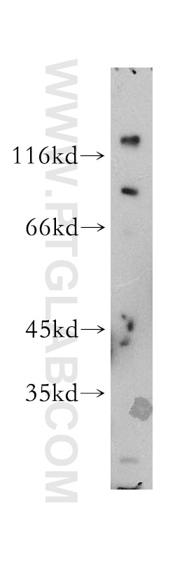 WB analysis of Apoptosised HeLa using 13252-1-AP