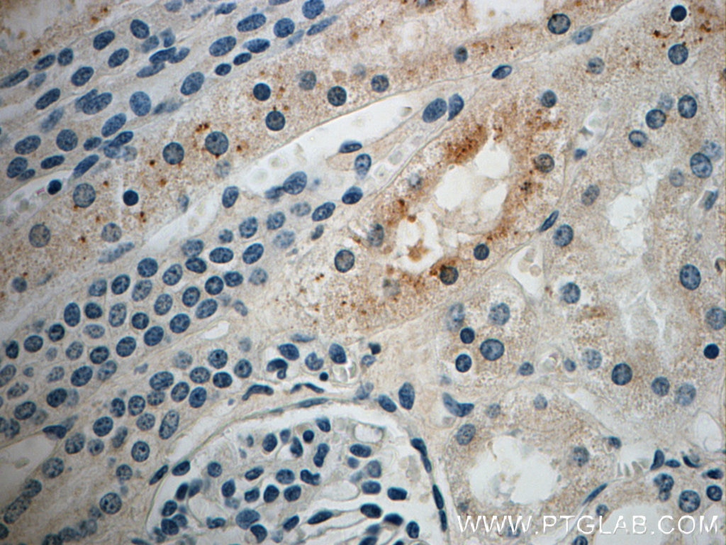 Immunohistochemistry (IHC) staining of human kidney tissue using SRGAP2 Polyclonal antibody (22519-1-AP)