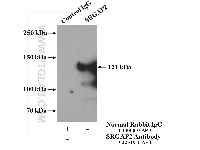 Immunoprecipitation (IP) experiment of HEK-293 cells using SRGAP2 Polyclonal antibody (22519-1-AP)