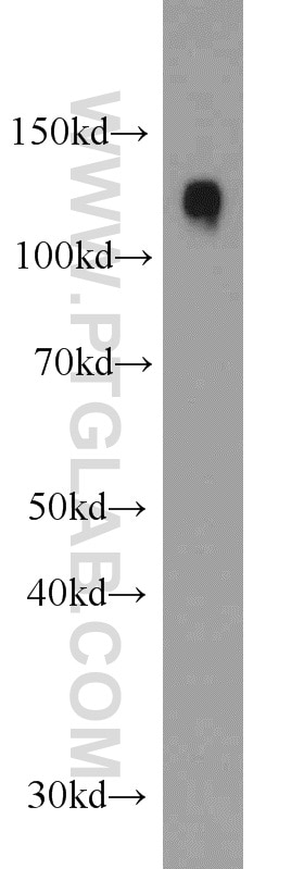 Western Blot (WB) analysis of mouse kidney tissue using SRGAP2 Polyclonal antibody (22519-1-AP)