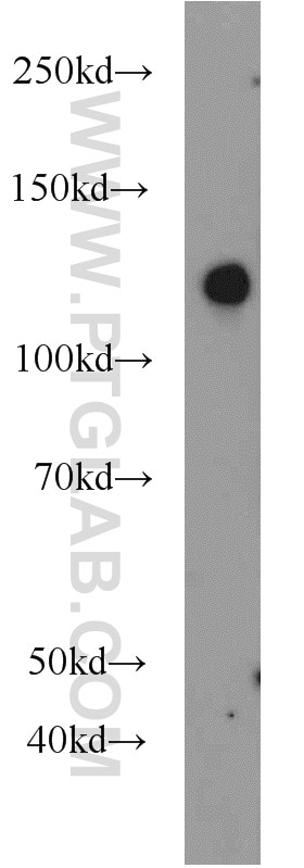 Western Blot (WB) analysis of mouse kidney tissue using SRGAP2 Polyclonal antibody (22519-1-AP)