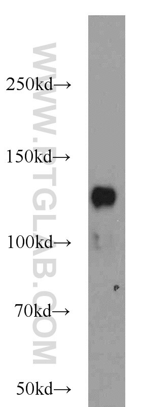 Western Blot (WB) analysis of HEK-293 cells using SRGAP2 Polyclonal antibody (22519-1-AP)