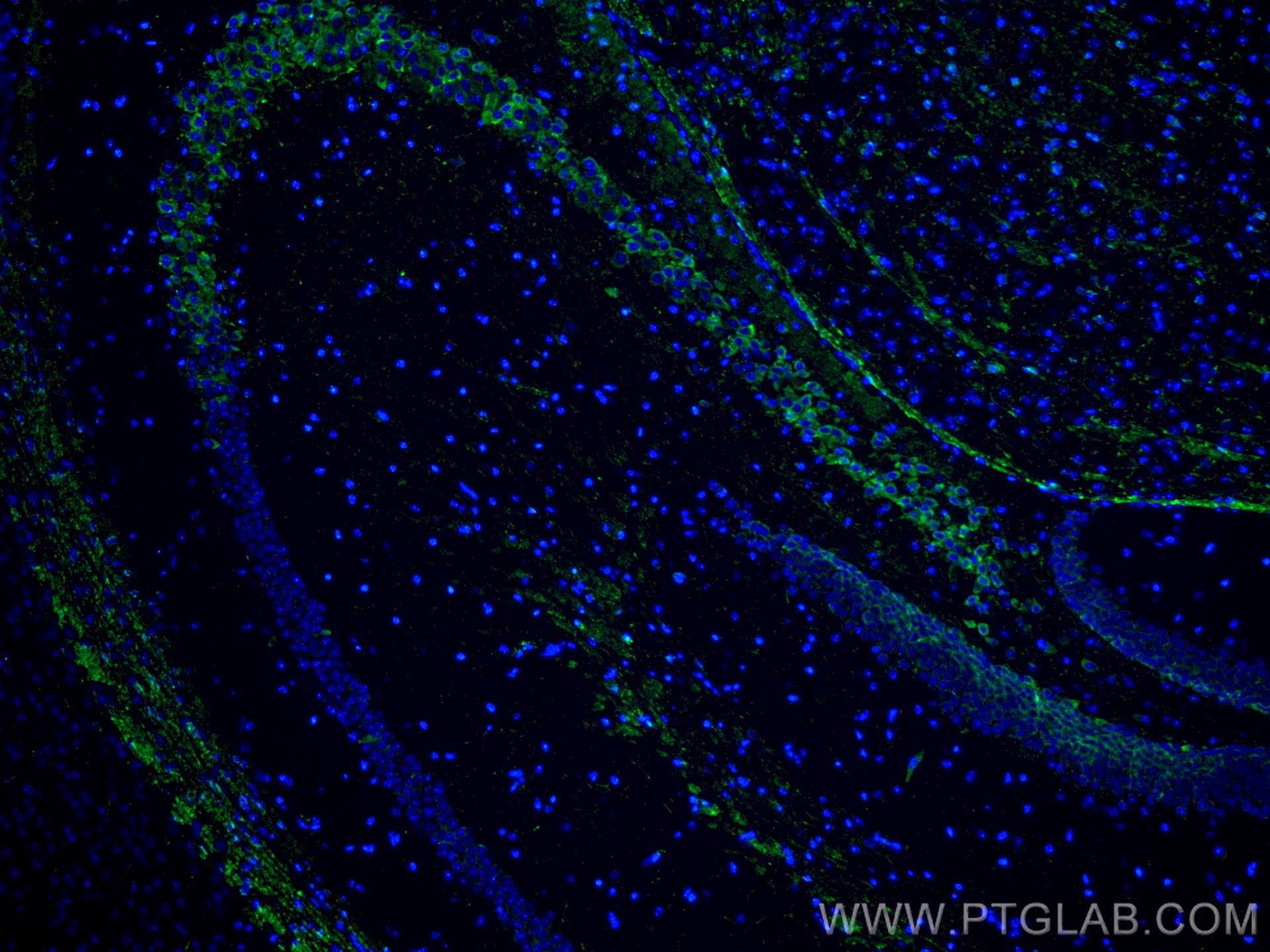 Immunofluorescence (IF) / fluorescent staining of mouse brain tissue using SRGAP3 Polyclonal antibody (29624-1-AP)