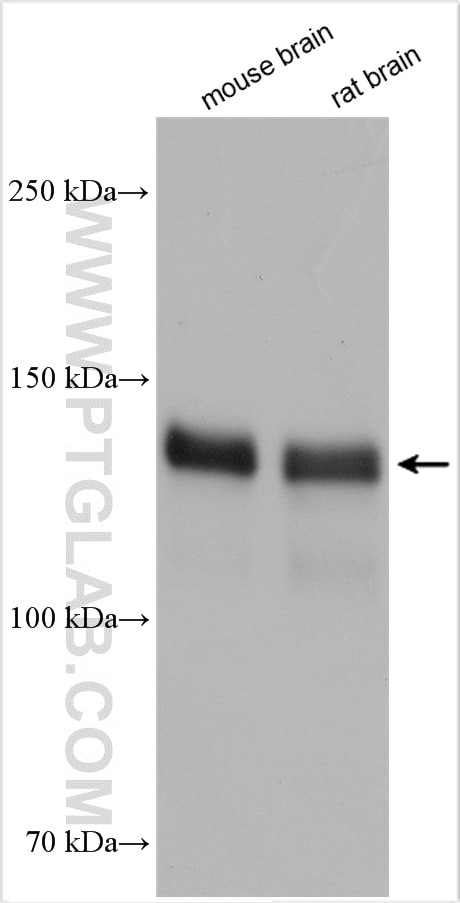 Western Blot (WB) analysis of various lysates using SRGAP3 Polyclonal antibody (29624-1-AP)