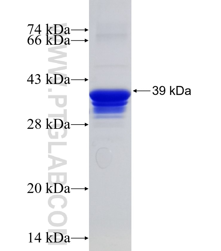 SRGAP3 fusion protein Ag31196 SDS-PAGE