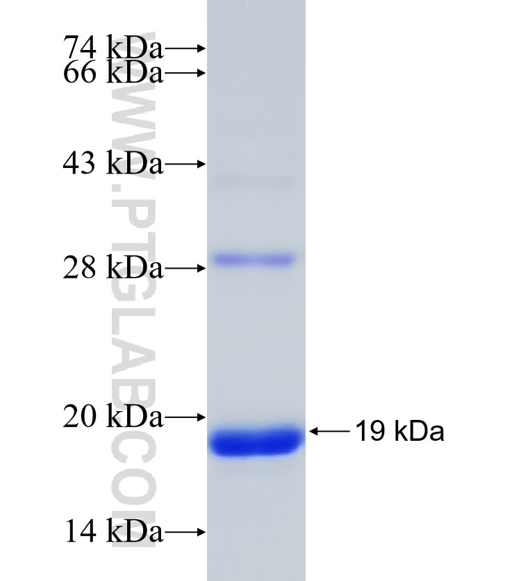 SRGAP3 fusion protein Ag31205 SDS-PAGE SRGAP3 fusion protein Ag31205 SDS-PAGE