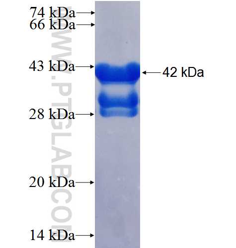 SRGN fusion protein Ag2996 SDS-PAGE