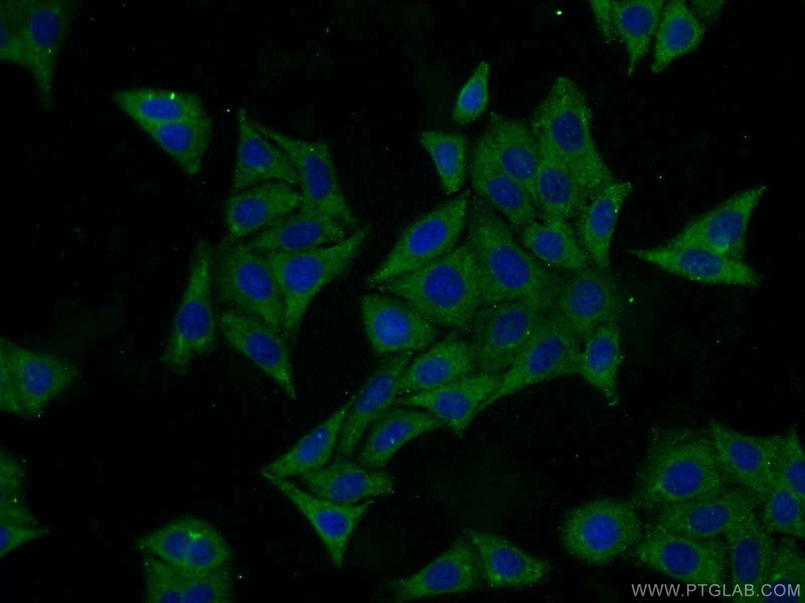Immunofluorescence (IF) / fluorescent staining of HepG2 cells using SRI Polyclonal antibody (16471-1-AP)