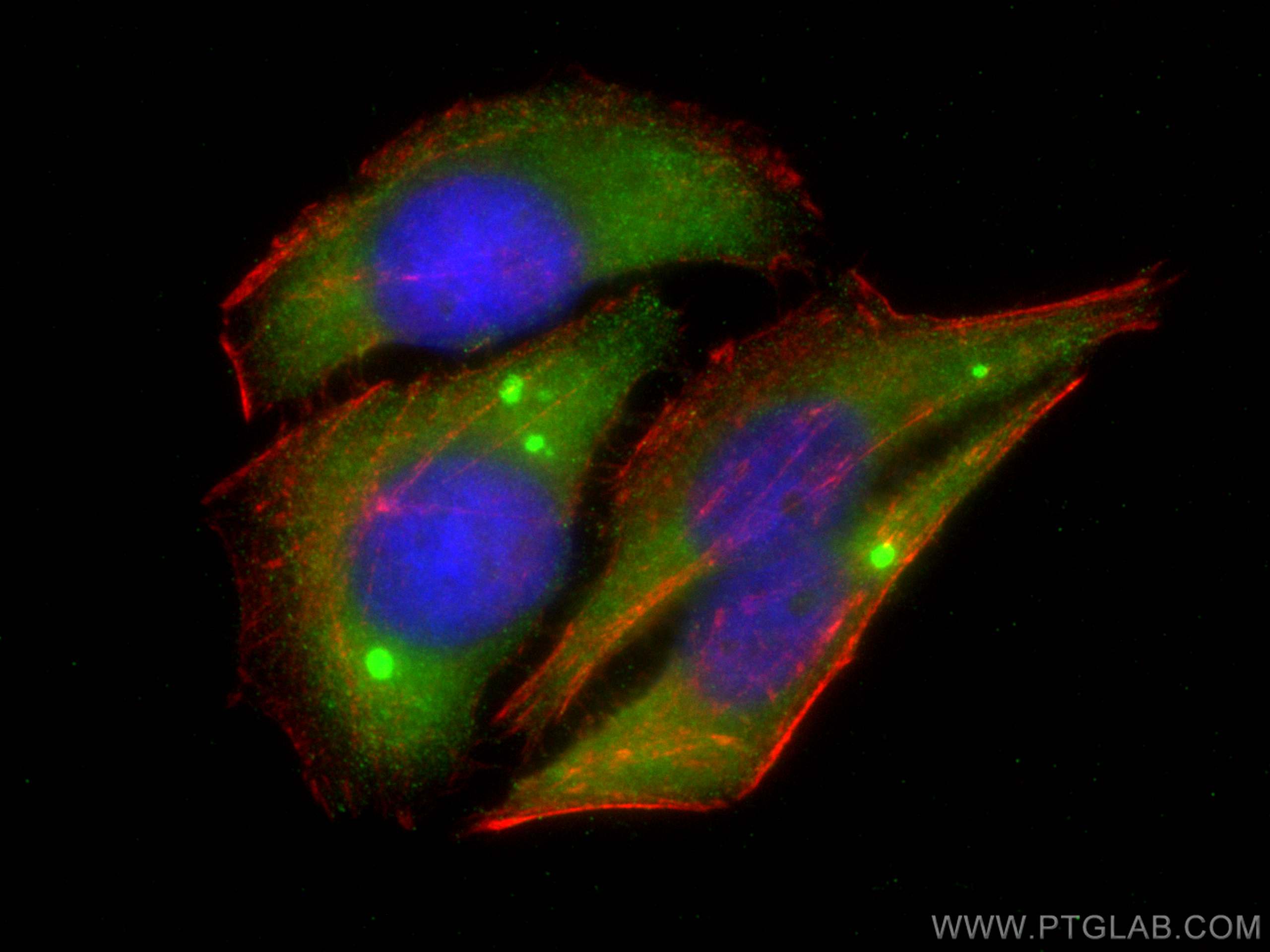 IF Staining of HepG2 using 16471-1-AP