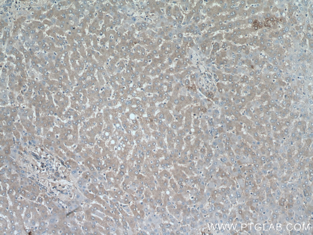 Immunohistochemistry (IHC) staining of human liver tissue using SRI Polyclonal antibody (16471-1-AP)