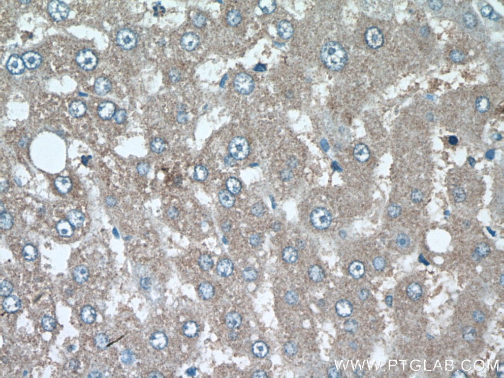 Immunohistochemistry (IHC) staining of human liver tissue using SRI Polyclonal antibody (16471-1-AP)