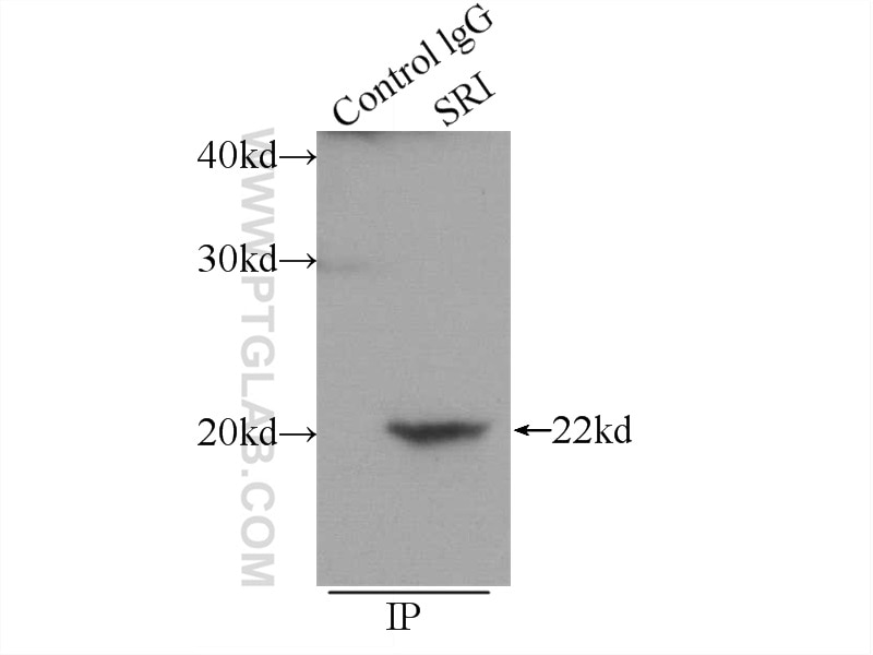 Immunoprecipitation (IP) experiment of HepG2 cells using SRI Polyclonal antibody (16471-1-AP)