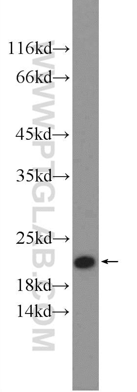 Western Blot (WB) analysis of mouse liver tissue using SRI Polyclonal antibody (16471-1-AP)