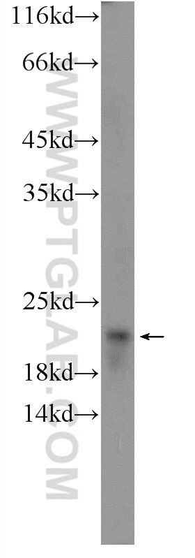 Western Blot (WB) analysis of rat liver tissue using SRI Polyclonal antibody (16471-1-AP)