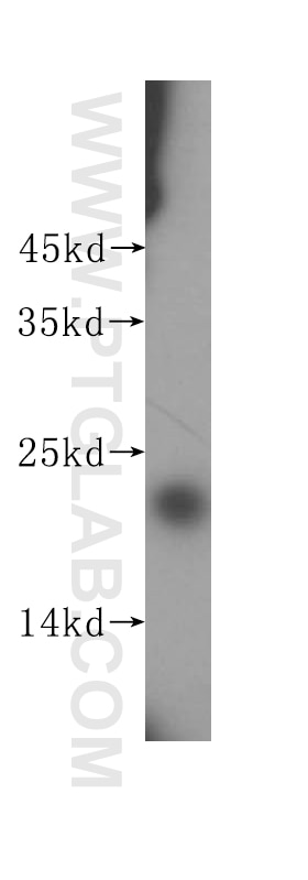 Western Blot (WB) analysis of HepG2 cells using SRI Polyclonal antibody (16471-1-AP)