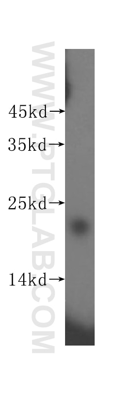 Western Blot (WB) analysis of human liver tissue using SRI Polyclonal antibody (16471-1-AP)