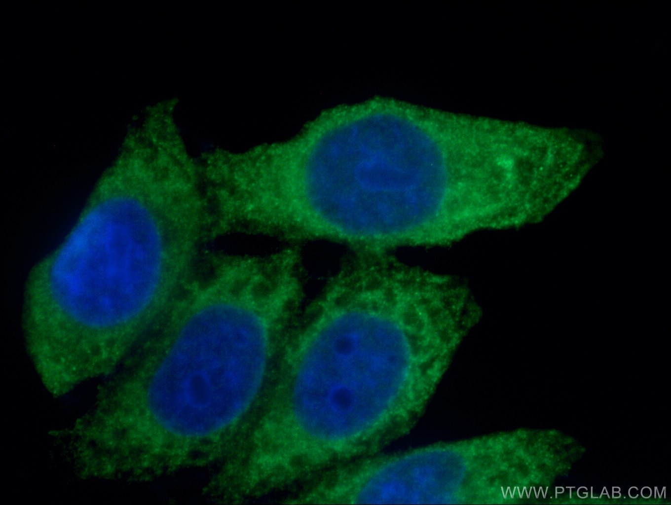 Spermidine synthase