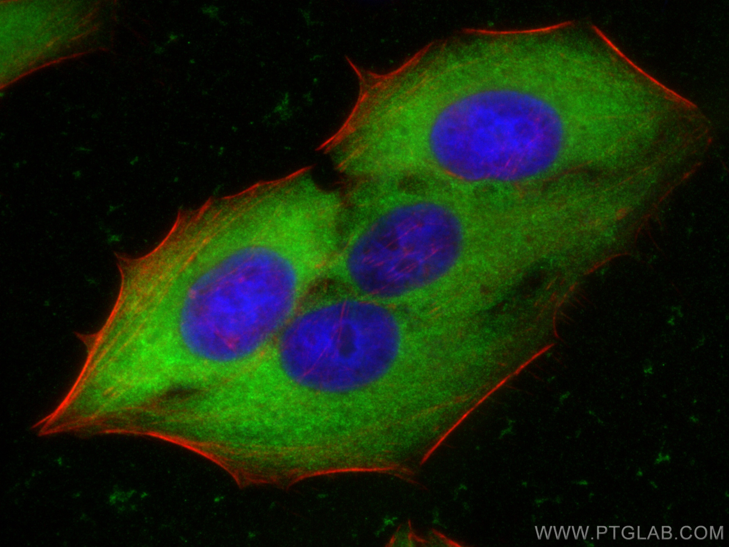 Immunofluorescence (IF) / fluorescent staining of HepG2 cells using Spermidine synthase Polyclonal antibody (19858-1-AP)