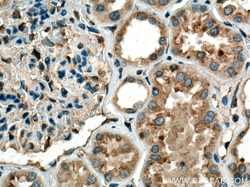 Immunohistochemistry (IHC) staining of human kidney tissue using Spermidine synthase Polyclonal antibody (19858-1-AP)