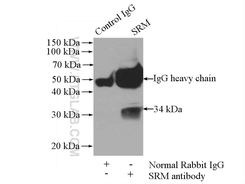 Immunoprecipitation (IP) experiment of mouse liver tissue using Spermidine synthase Polyclonal antibody (19858-1-AP)