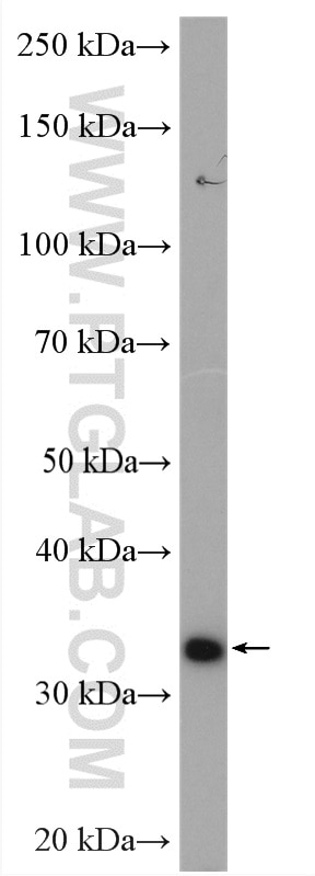 Western Blot (WB) analysis of LNCaP cells using Spermidine synthase Polyclonal antibody (19858-1-AP)