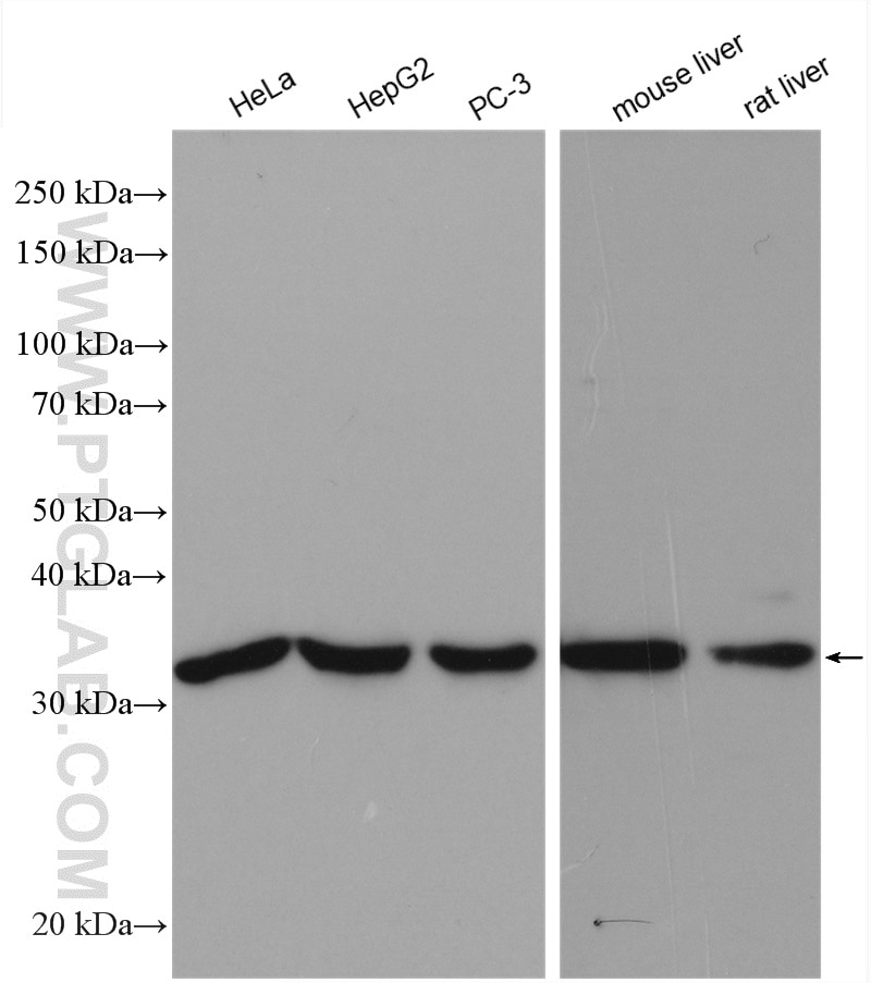 Western Blot (WB) analysis of various lysates using Spermidine synthase Polyclonal antibody (19858-1-AP)
