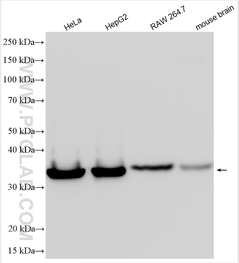 Western Blot (WB) analysis of various lysates using Spermidine synthase Polyclonal antibody (19858-1-AP)