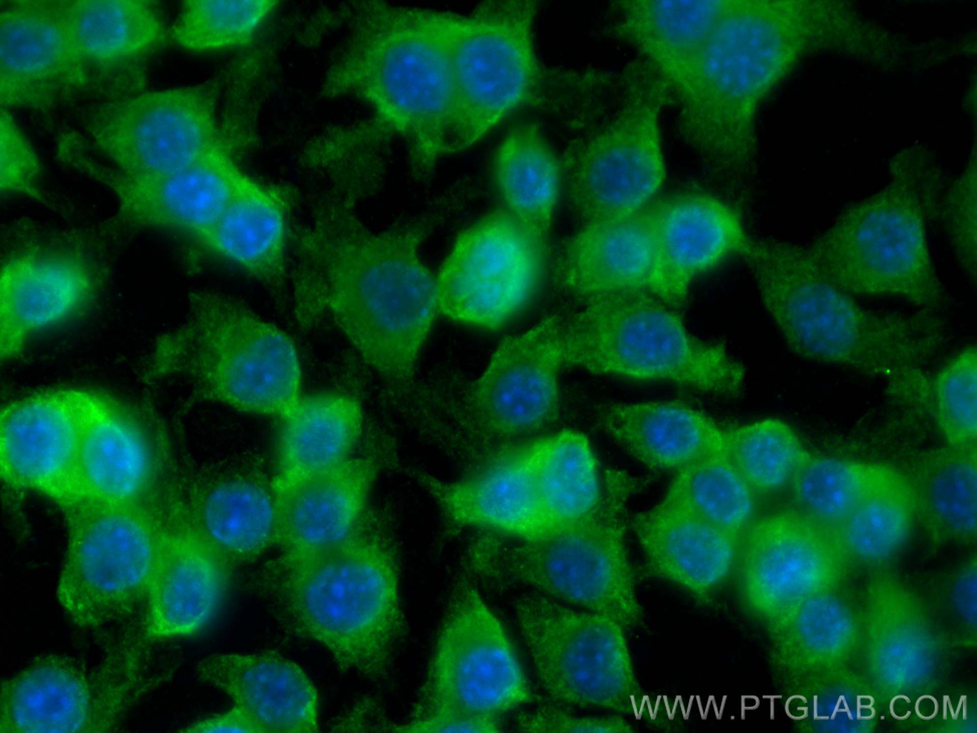 Immunofluorescence (IF) / fluorescent staining of RAW 264.7 cells using Spermidine synthase Monoclonal antibody (68548-1-Ig)