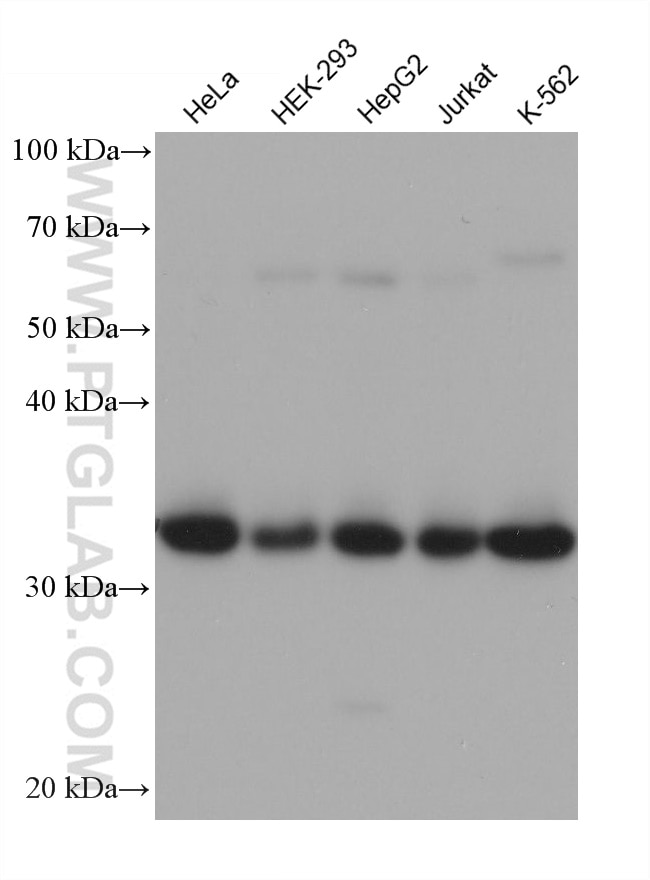 Western Blot (WB) analysis of various lysates using Spermidine synthase Monoclonal antibody (68548-1-Ig)