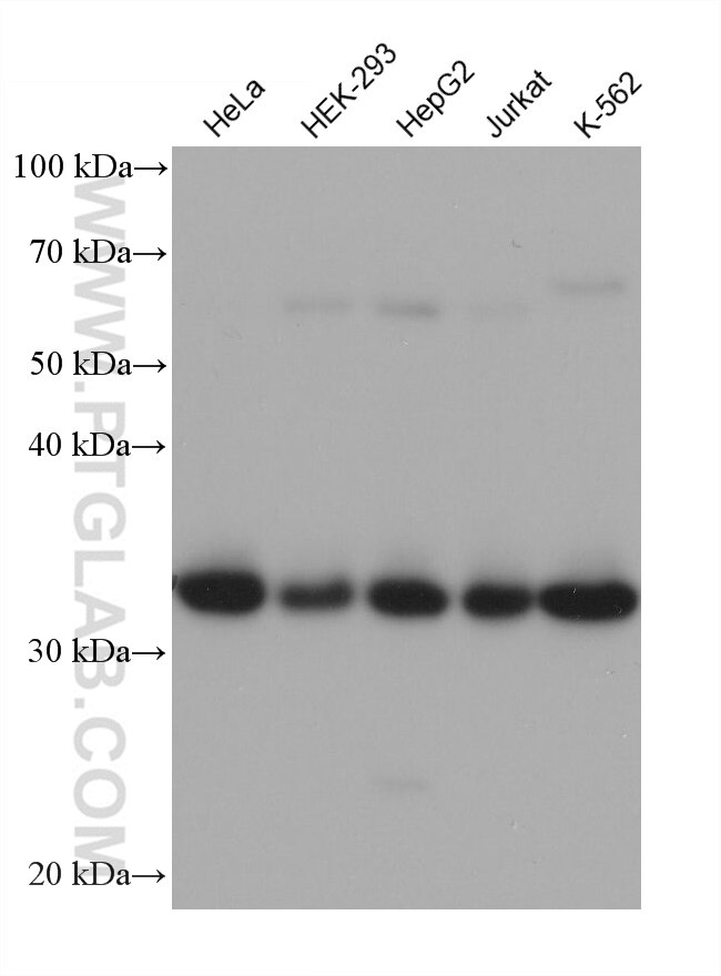 Spermidine synthase