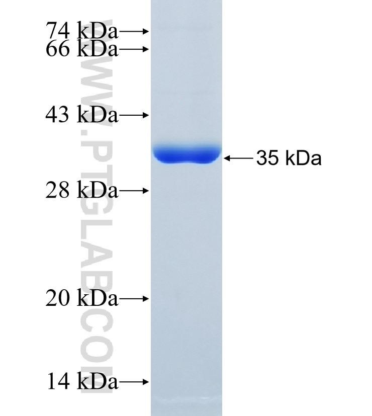 SRM fusion protein Ag33919 SDS-PAGE