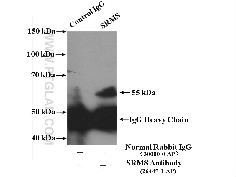 Immunoprecipitation (IP) experiment of HL-60 cells using SRMS Polyclonal antibody (26447-1-AP)