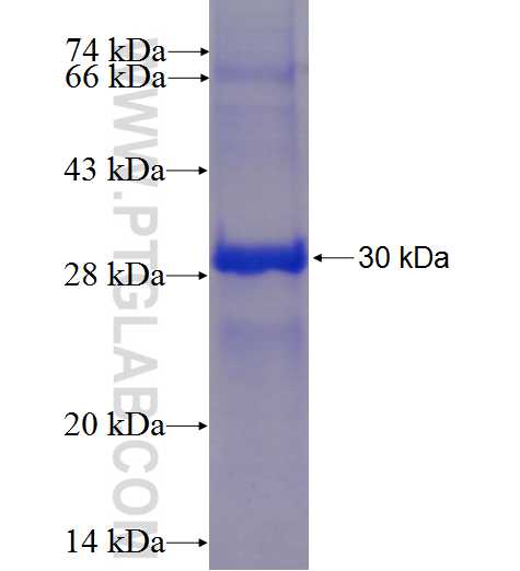 SRMS fusion protein Ag24062 SDS-PAGE