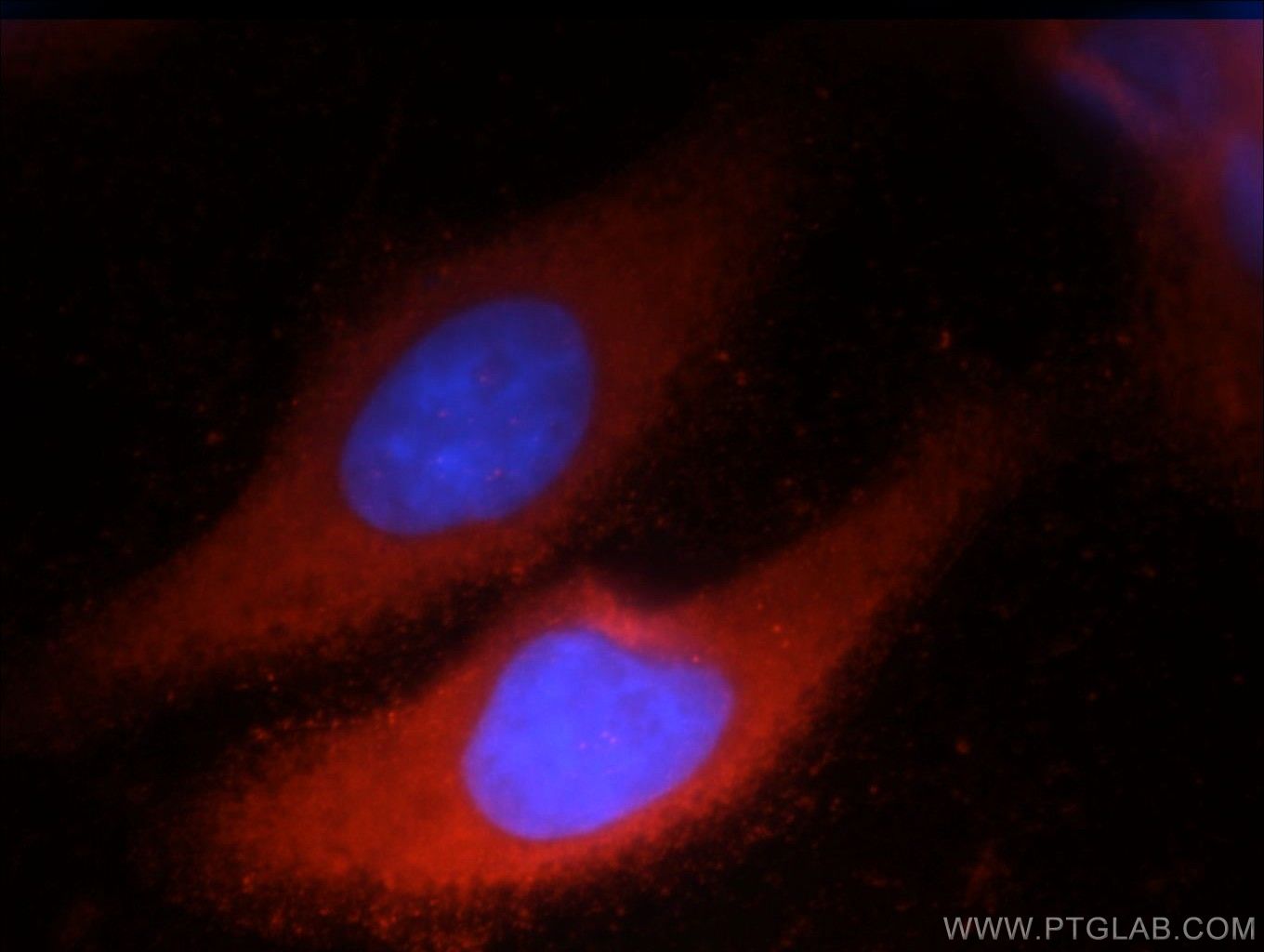 Immunofluorescence (IF) / fluorescent staining of HepG2 cells using SRP14 Polyclonal antibody (11528-1-AP)
