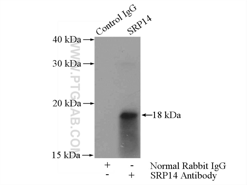 Immunoprecipitation (IP) experiment of A549 cells using SRP14 Polyclonal antibody (11528-1-AP)