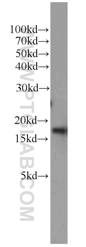 Western Blot (WB) analysis of HeLa cells using SRP14 Polyclonal antibody (11528-1-AP)