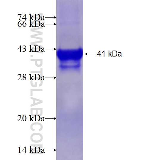 SRP14 fusion protein Ag2099 SDS-PAGE