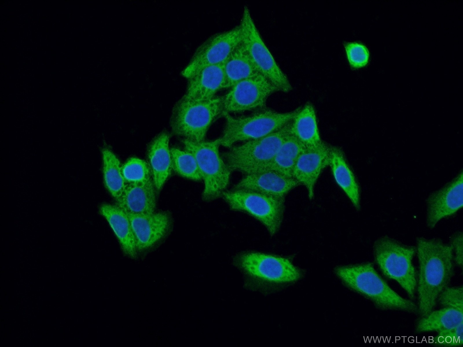 Immunofluorescence (IF) / fluorescent staining of HeLa cells using SRP19 Polyclonal antibody (16033-1-AP)