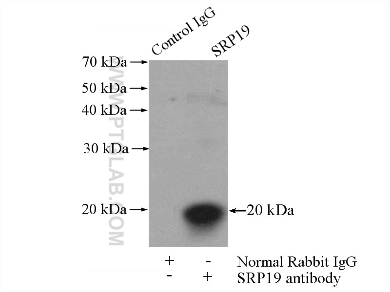 Immunoprecipitation (IP) experiment of mouse kidney tissue using SRP19 Polyclonal antibody (16033-1-AP)